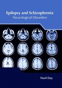 bokomslag Epilepsy and Schizophrenia: Neurological Disorders