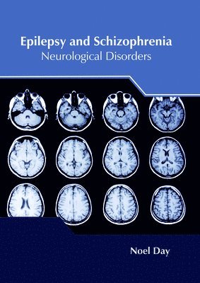 bokomslag Epilepsy and Schizophrenia: Neurological Disorders