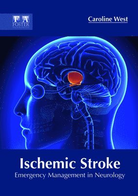 bokomslag Ischemic Stroke: Emergency Management in Neurology