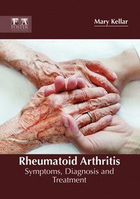 bokomslag Rheumatoid Arthritis: Symptoms, Diagnosis and Treatment