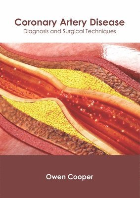 bokomslag Coronary Artery Disease: Diagnosis and Surgical Techniques