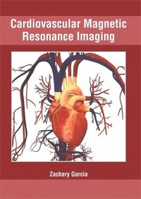 bokomslag Cardiovascular Magnetic Resonance Imaging