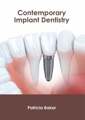 bokomslag Contemporary Implant Dentistry