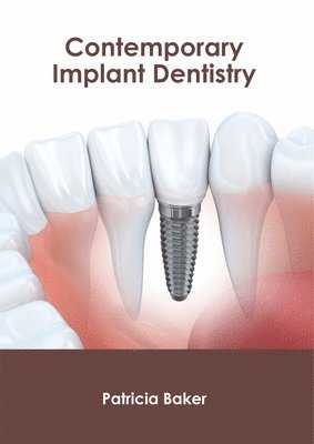 Patricia Baker - Contemporary Implant Dentistry, Inbunden