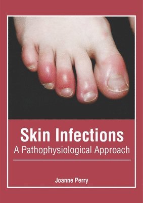 bokomslag Skin Infections: A Pathophysiological Approach