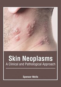 bokomslag Skin Neoplasms: A Clinical and Pathological Approach