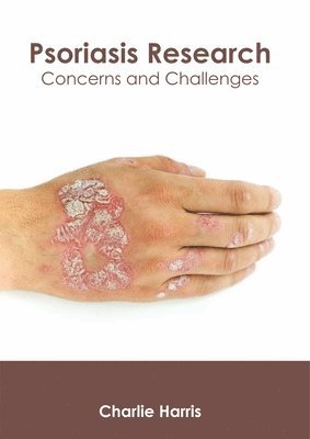Charlie Harris - Psoriasis Research: Concerns and Challenges, Inbunden