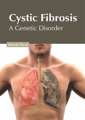 bokomslag Cystic Fibrosis: A Genetic Disorder