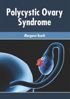 Margaret Booth - Polycystic Ovary Syndrome, Inbunden