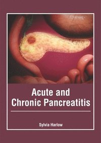 bokomslag Acute and Chronic Pancreatitis