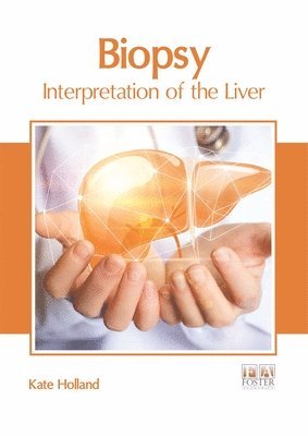 Kate Holland - Biopsy: Interpretation of the Liver, Inbunden
