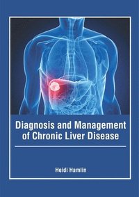 bokomslag Diagnosis and Management of Chronic Liver Disease