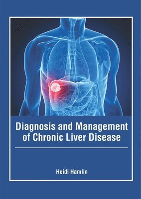 Diagnosis and Management of Chronic Liver Disease 1