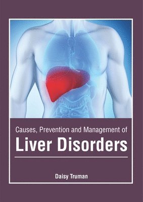 bokomslag Causes, Prevention and Management of Liver Disorders