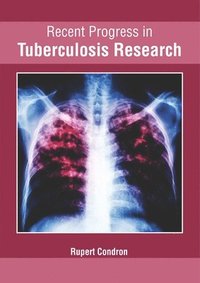 bokomslag Recent Progress in Tuberculosis Research