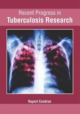 Recent Progress in Tuberculosis Research 1