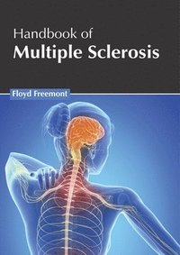 bokomslag Handbook of Multiple Sclerosis