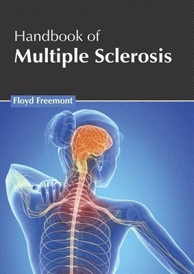 bokomslag Handbook of Multiple Sclerosis