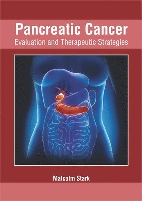 Malcolm Stark - Pancreatic Cancer: Evaluation and Therapeutic Strategies, Inbunden