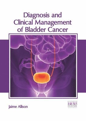 Diagnosis and Clinical Management of Bladder Cancer 1