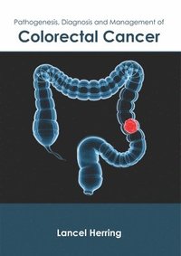 bokomslag Pathogenesis, Diagnosis and Management of Colorectal Cancer