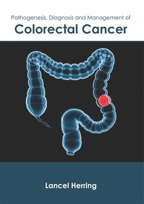 Pathogenesis, Diagnosis and Management of Colorectal Cancer 1