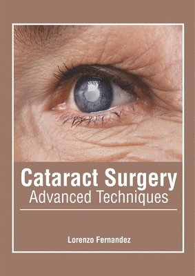 bokomslag Cataract Surgery: Advanced Techniques