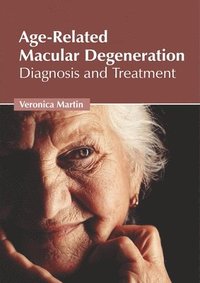 bokomslag Age-Related Macular Degeneration: Diagnosis and Treatment