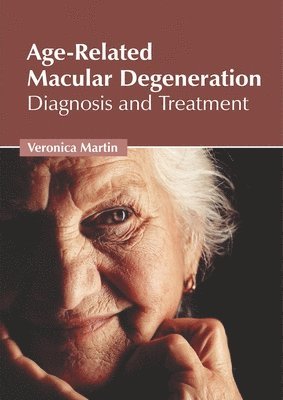 Age-Related Macular Degeneration: Diagnosis and Treatment 1