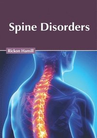 bokomslag Spine Disorders
