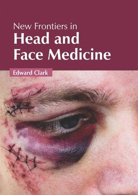 Edward Clark - New Frontiers in Head and Face Medicine, Inbunden