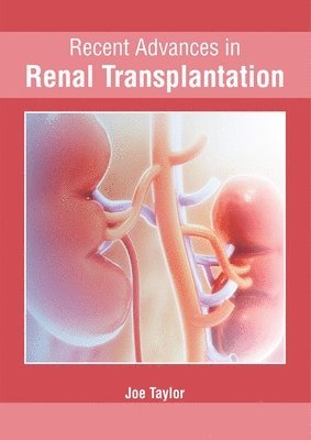 bokomslag Recent Advances in Renal Transplantation
