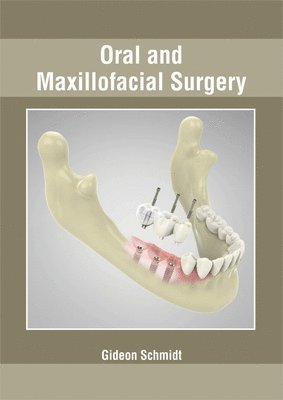 Gideon Schmidt - Oral and Maxillofacial Surgery, Inbunden