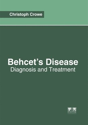 Behcet's Disease: Diagnosis and Treatment 1