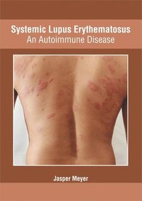 bokomslag Systemic Lupus Erythematosus: An Autoimmune Disease