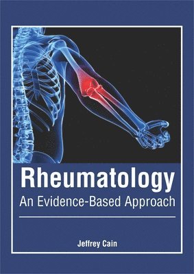 bokomslag Rheumatology: An Evidence-Based Approach