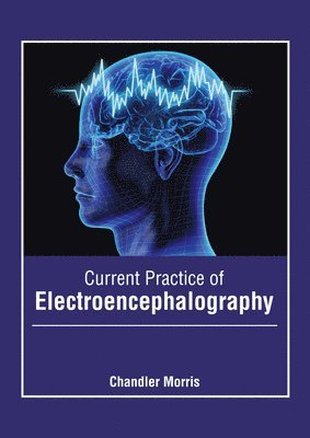 Current Practice of Electroencephalography 1