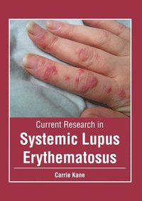 bokomslag Current Research in Systemic Lupus Erythematosus