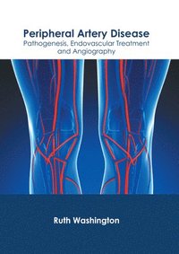 bokomslag Peripheral Artery Disease: Pathogenesis, Endovascular Treatment and Angiography