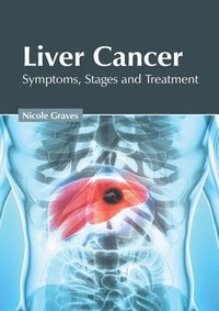 bokomslag Liver Cancer: Symptoms, Stages and Treatment