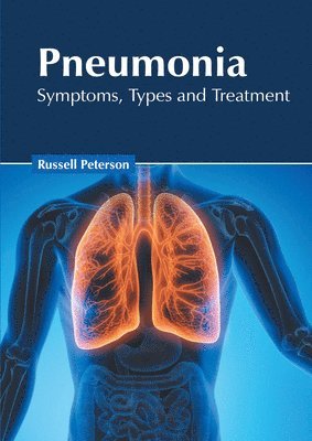 Russell Peterson - Pneumonia: Symptoms, Types and Treatment, Inbunden