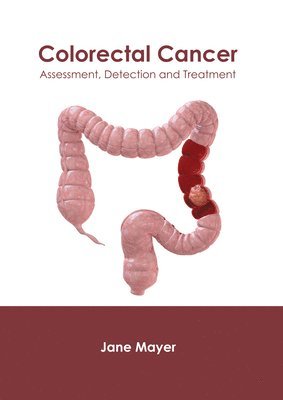 bokomslag Colorectal Cancer: Assessment, Detection and Treatment