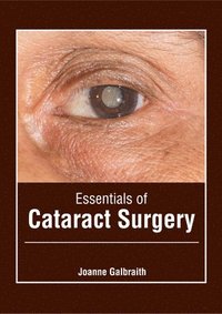 bokomslag Essentials of Cataract Surgery
