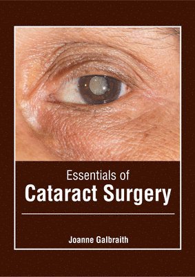 Essentials of Cataract Surgery 1