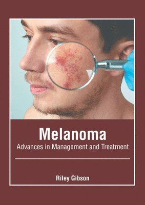 bokomslag Melanoma: Advances in Management and Treatment