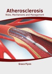 bokomslag Atherosclerosis: Risks, Mechanisms and Management