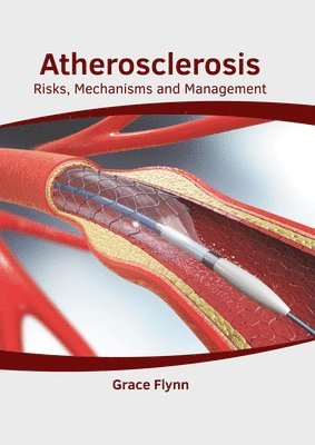 bokomslag Atherosclerosis: Risks, Mechanisms and Management