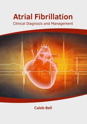 Atrial Fibrillation: Clinical Diagnosis and Management 1