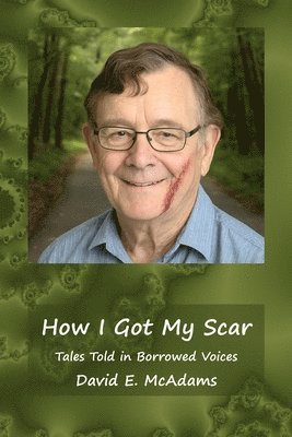 bokomslag How I Got My Scar