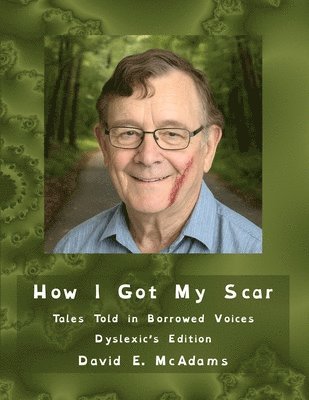bokomslag How I Got My Scar